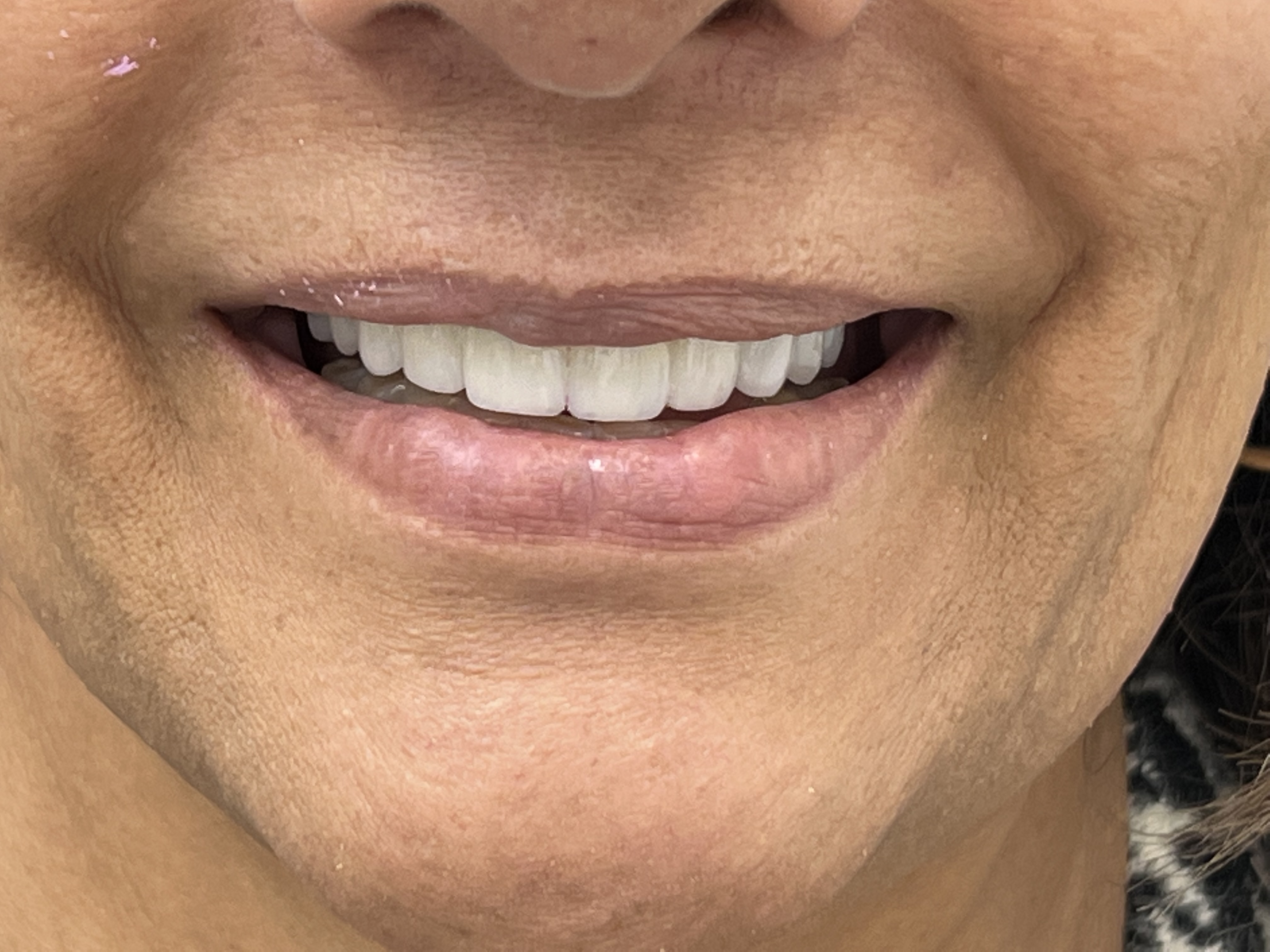 Sonrisa Rosalba